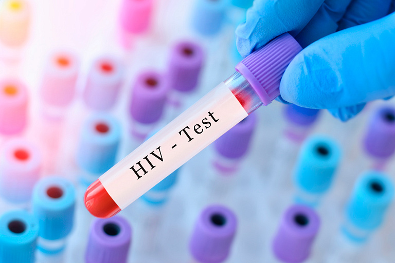 Узнали, в какой области Беларуси самая высокая заболеваемость ВИЧ