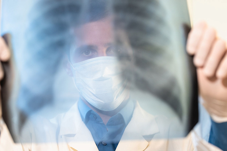 После ковида у белорусов стали чаще выявлять бронхиальную астму – врач