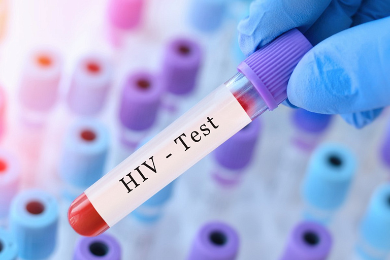 У кого чаще находят ВИЧ в столичном регионе, рассказали эпидемиологи